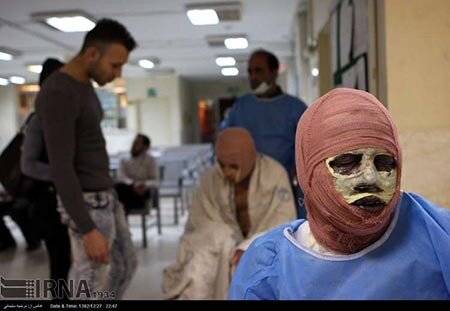تخلیه چشمِ یک مصدوم در شب چهارشنبه سوری