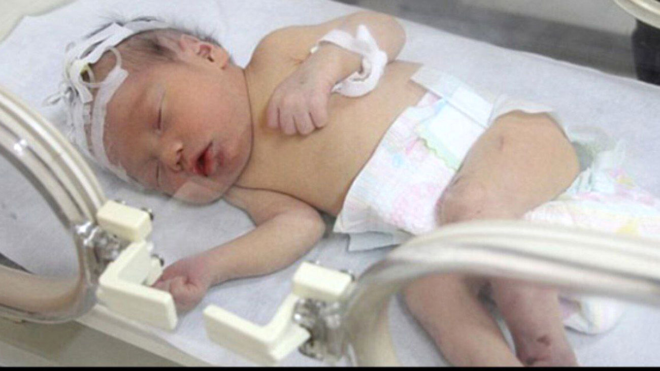 حادثه تلخ برای نوزاد 5 ماهه/ پزشکان هشدار دادند